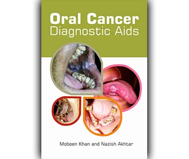 Oral Cancer Diagnostic Aids